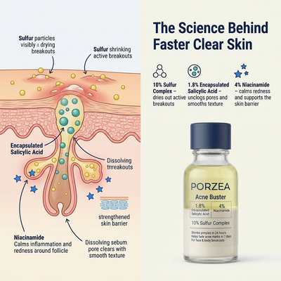 Porzea Pimple Treatment & Body Acne Treatment